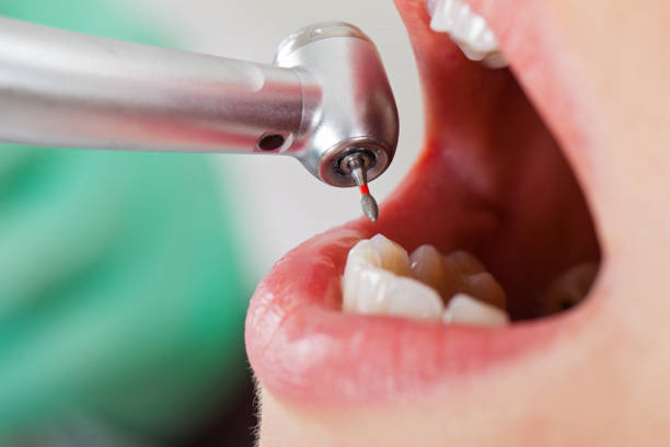 Best Emergency Dental Surgery in Olivet, MI